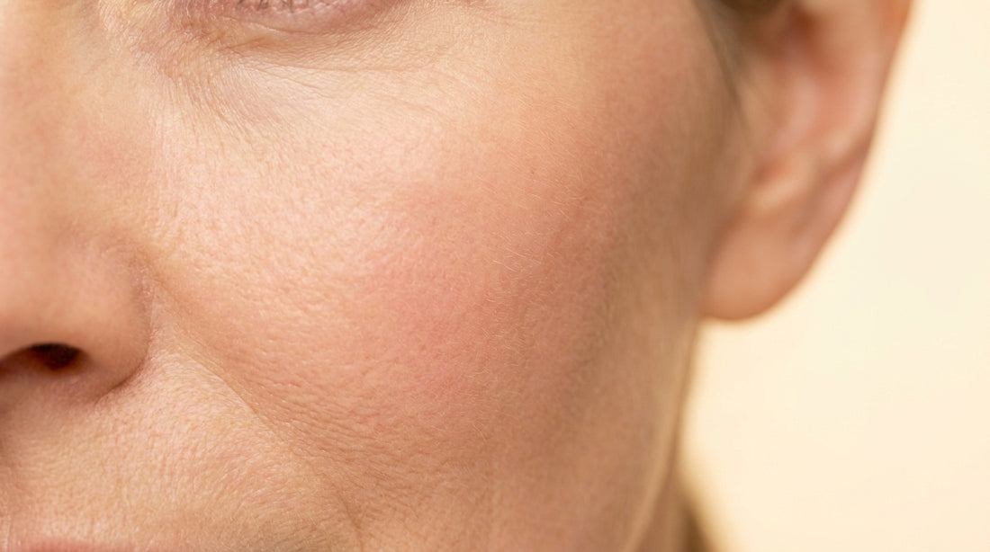 Close-up of clear, even-toned facial skin without redness